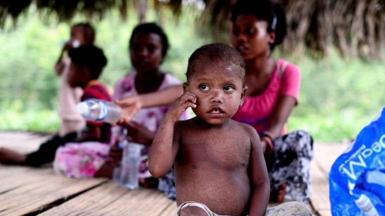 Bukan Misteri Tapi Demam Campak, Kematian Orang Asli Kuala Koh Terjawab