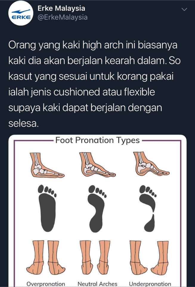 Kenali 3 Jenis Bentuk Kaki Korang Supaya Tak Salah Beli Sport Shoes