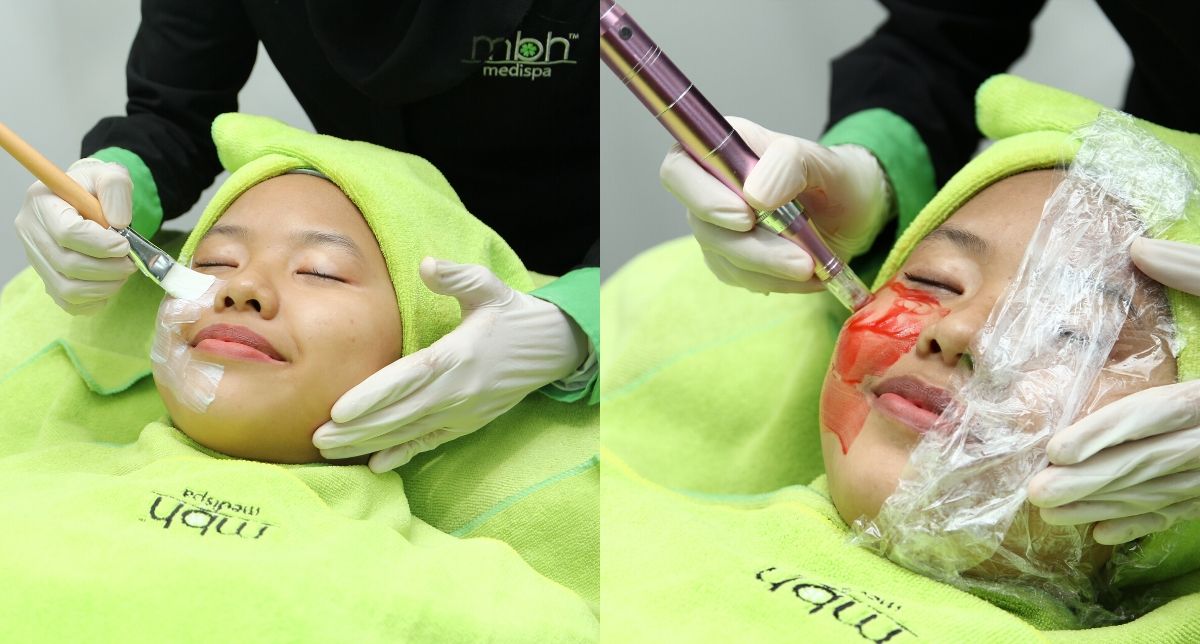 [PERADUAN] Baucar Spa Bagi Rawatan MBH Therapeutic Face Therapy, Barulah Relax