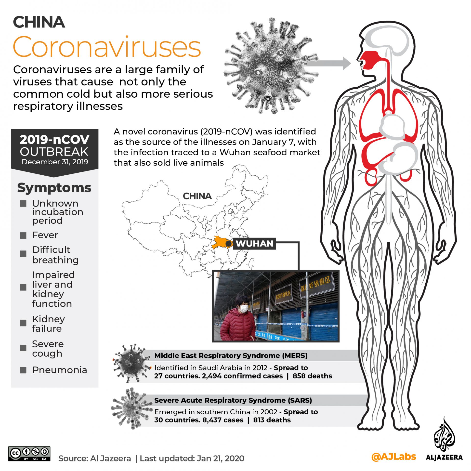 Wabak Virus Korona Semakin Serius, 8 Warga China Dikuarantin Di Johor Bahru  Pula!