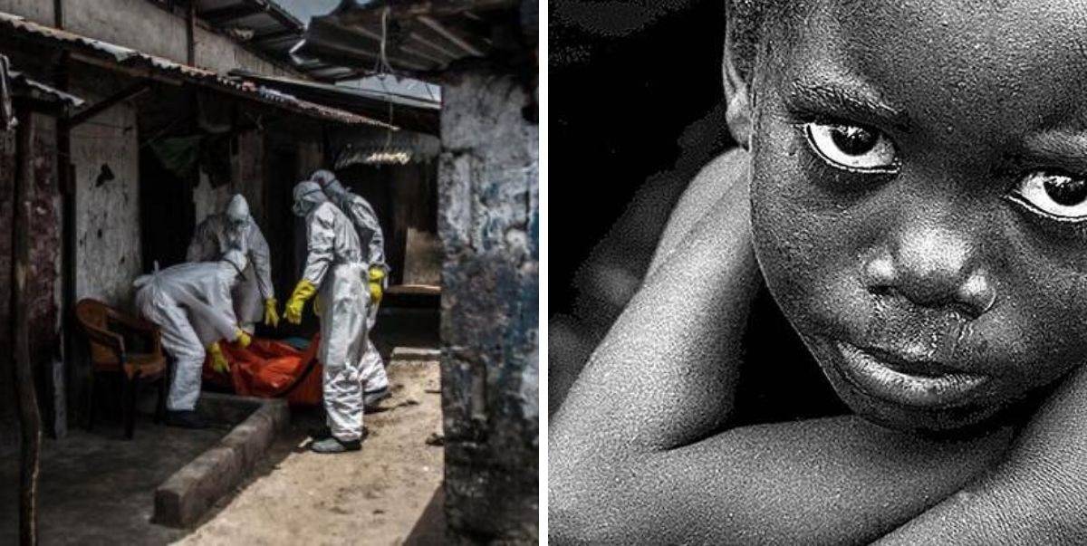 Giliran Afrika Pula Dilanda Wabak Misteri! Simptom Muntah, Cirit Birit &#038; Akan Mati Dalam 2 Hari