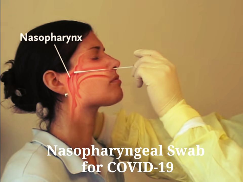 “Azab &#038; Kepala Rasa Nak Meletup”! Doktor Kongsi Rasa Sakit Dirasai Ketika Pengambilan Sample  Ujian Saringan COVID-19