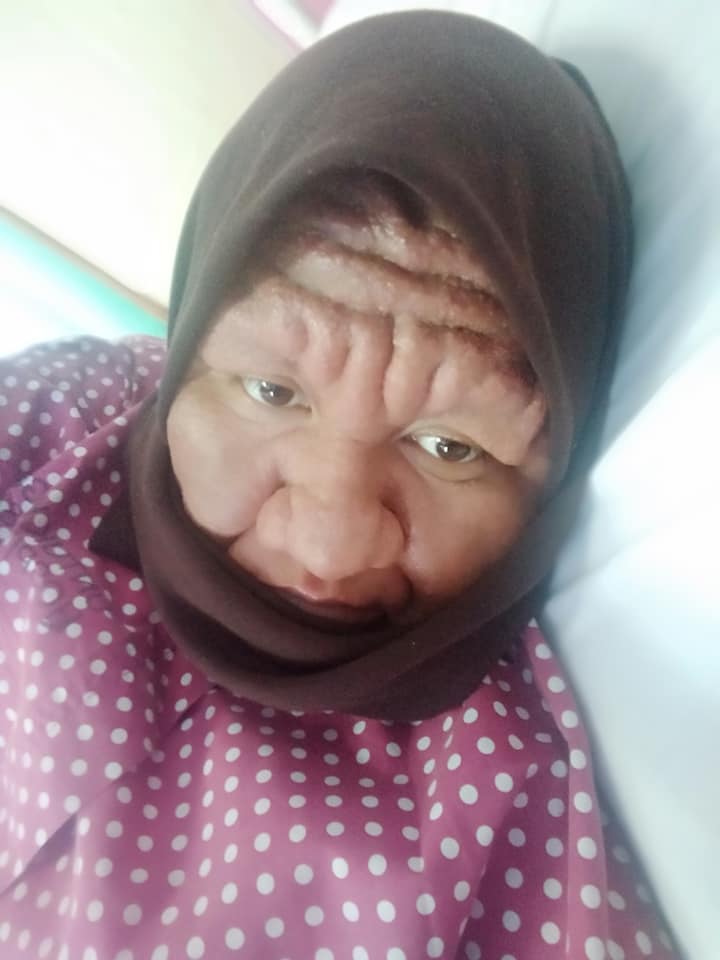 Muka Berubah Jadi Tua Saat Mengandung, Perkongsian Wanita Ini Jadi Viral