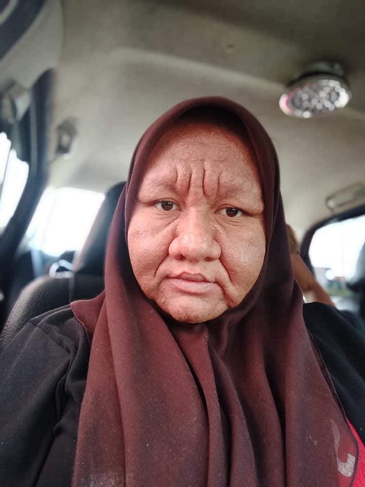 Muka Berubah Jadi Tua Saat Mengandung, Perkongsian Wanita Ini Jadi Viral