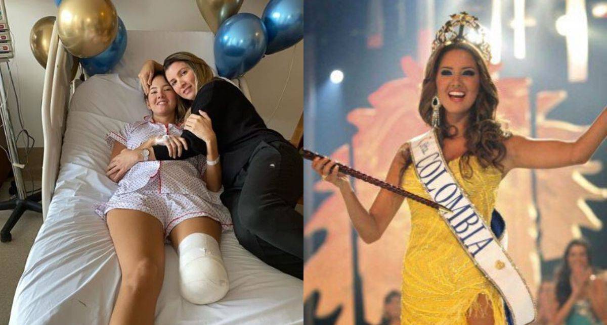 Miss Universe Colombia Hilang Sebelah Kaki Akibat Benjolan Di Perut
