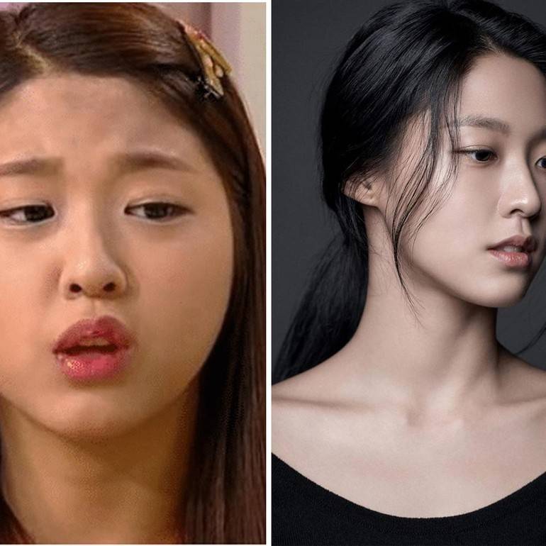 7 Artis Korea Sebelum Dan Selepas Diet, Wajah Berubah Macam Buat Pembedahan!