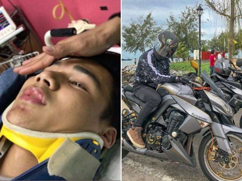 “Saya Okay, Peha Teruk Sikit” Atiq Azman Syukur Selamat Kemalangan Motosikal