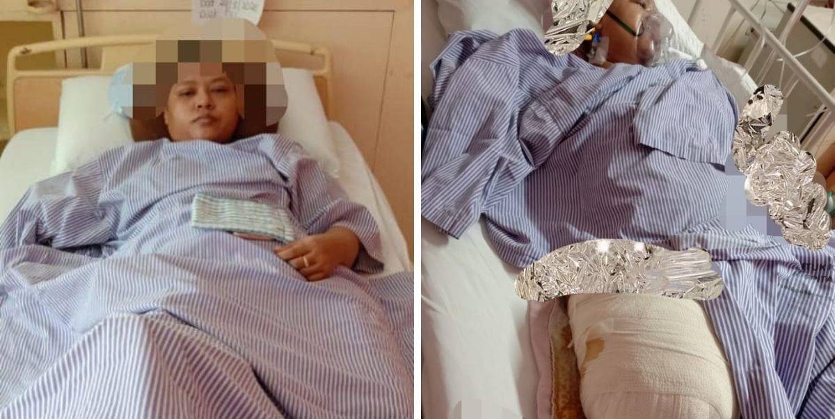 Setahun Selepas Tangan Dipotong Akibat Terlibat Kemalangan Ngeri, Wanita Redha Kaki Juga Perlu Dibuang