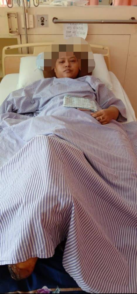Setahun Selepas Tangan Dipotong Akibat Terlibat Kemalangan Ngeri, Wanita Redha Kaki Juga Perlu Dibuang