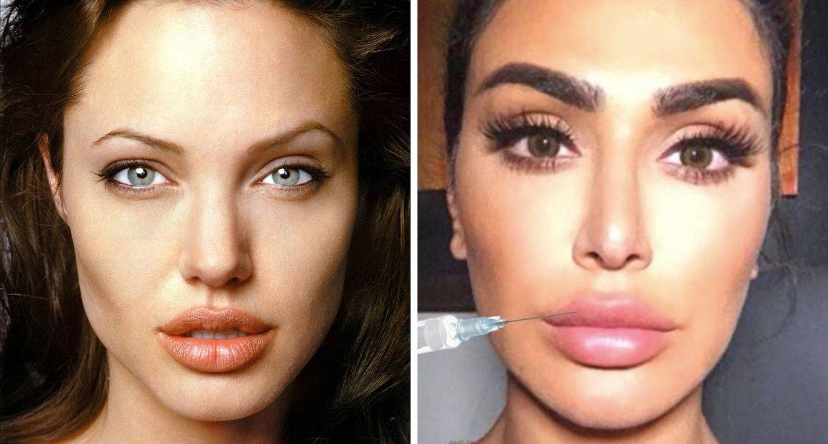 Tak Perlu Buat ‘Filler’, 3 Trik Mudah Ini Bantu Bibir Munggil Macam Angelina Jolie