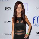 Film Lizzie Velasquez