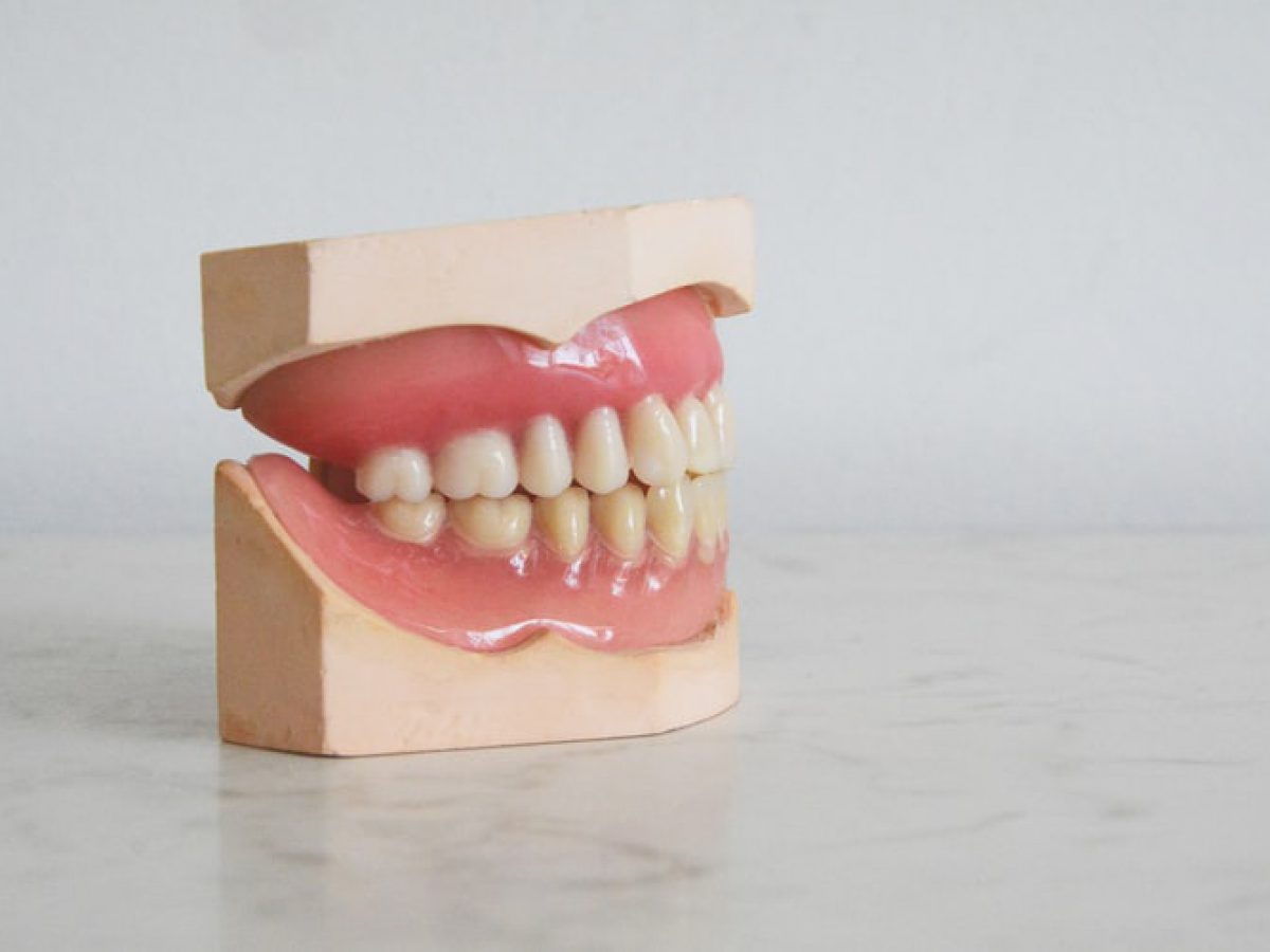 Masalah Gigi Berlapis Ini Punca Rawatan Yang Boleh Dilakukan Remaja