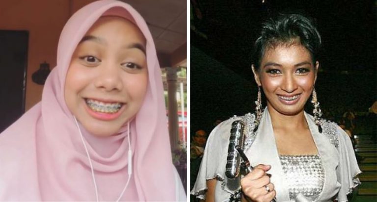 7 Selebriti Yang Pernah Pakai Braces, Hasilnya Kini Gigi Cantik Dan Senyuman Menawan