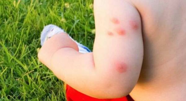 Berkesan Tapi Bahaya Untuk Kesihatan, Ubat Nyamuk ‘Viral’ Boleh Akibat Kanser