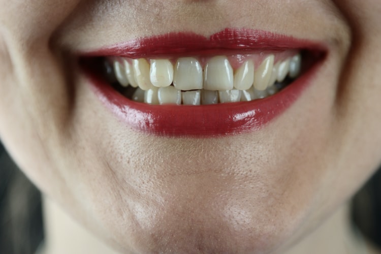 Doktor Ini Kongsi 6 Tip Elak Mulut Berbau Ketika Berpuasa