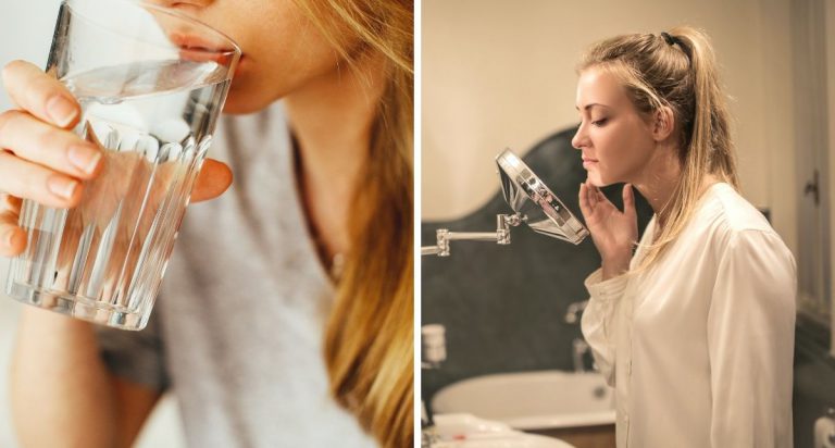 Serik Pakai Produk Skincare, Ini 8 Tip ‘Acne Diet’ Untuk Kulit Jerawat
